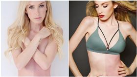 Taylor Muhl,女模,嵌合體,雙胞胎,膚色,DNA,罕病／IG