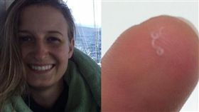 美國女子眼皮藏寄生蟲_CNN推特