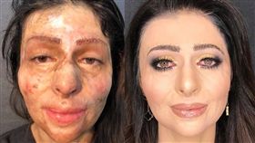 火吻,傷疤,化妝（圖／臉書、IG https://www.facebook.com/justgirlyth/videos/vb.1744413505778371/2127595664126818/?type=2&theater）