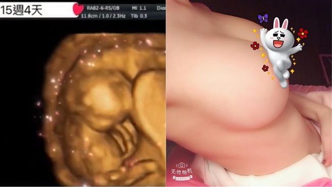 情人節曬半裸凸肚照　她嘆台女不獨立