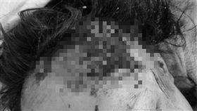 國道翻覆　9歲女童拋飛頭部削整塊皮／翻攝畫面