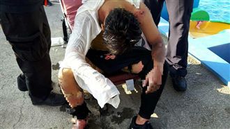 男玩卡丁車皮燒掉命危　網曝當時情況