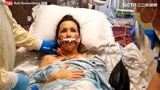 女子接受肺移植　第一口氣讓她瞪大眼