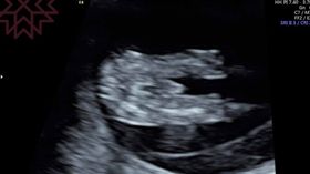 太不科學！T妹寶寶超音波驚見「超級大屌」(圖/翻攝自T妹臉書)