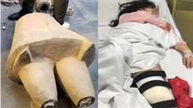 5歲女童摸一下山寨兵馬俑，竟被砸到重傷骨折。（圖／翻攝都市快報）