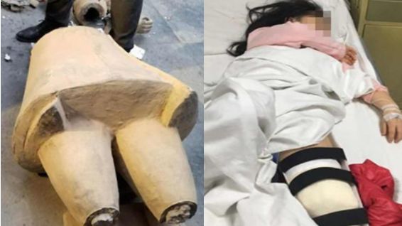 山寨兵馬俑一摸就倒　女童被壓斷腳