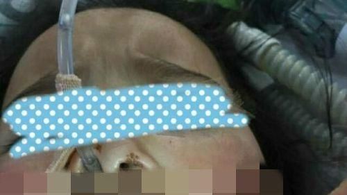 2歲童發燒抽蓄　家長灌熱水燒爛喉嚨