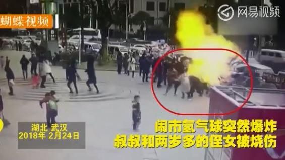 兩歲女童買氣球　突爆炸起火燒毀臉蛋