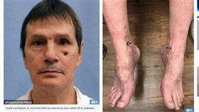 美國,阿拉巴馬州,死刑犯,毒液,毒針,死刑,死囚,癌症,血管,血尿,酷刑（圖／翻攝自太陽報）