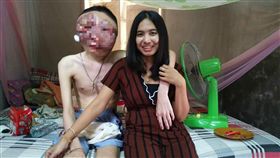 泰國一名女網友常姞（Atittaya Chumkeaw）常在臉書放閃，分享她與罹癌男友的幸福合照。她男友因罹癌導致臉部變形，但常姞不離不棄，23日還po出兩人合照一同慶祝交往3周年，不少網友看到之後十分感動，紛紛集氣希望她男友能早日康復。（圖／翻攝自Atittaya Chumkeaw臉書）