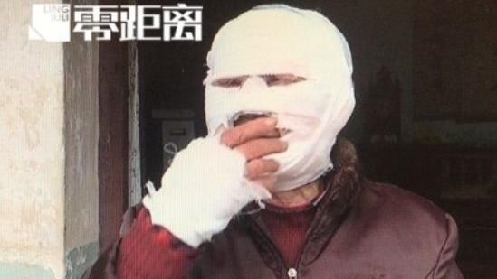天上掉下大氣球　老婦撿起竟爆炸