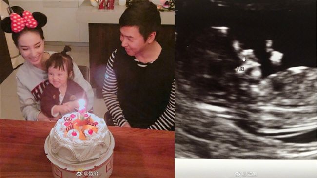 歐弟曬超音波照　宣告老婆懷2胎！