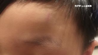 6歲童鬧情緒　父控遭園長強拉疑撞牆
