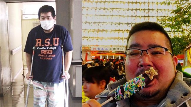 拓也哥罹糖尿病　腳指傷口見骨遭截肢