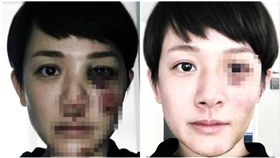 林彥君（合成圖／翻攝自臉書）