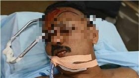 印度,車禍,鐵條,坎努爾市,Ullas Kumar　圖／翻攝自YouTube