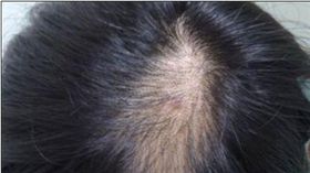 液體皂，可以溫和清潔同時可以滋潤保養頭皮與頭髮，