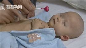 飛飛罕見的病例，令人不捨！（翻攝自鳳凰網）