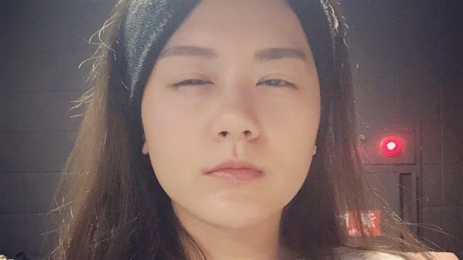 女星睡覺醒來嘴裡全碎　洩恐怖真相…