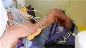 被自家狗狗咬傷的54歲男子圖引自《JSTV》