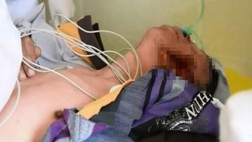 醉倒狗窩前　男子半張臉遭啃食