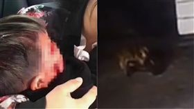 大陸,安徽,合肥,疤痕,縫針,狗,攻擊,玩耍,咬傷,男童,　圖／翻攝自澎湃新聞網　https://goo.gl/aBXtcA