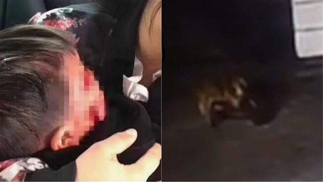男童社區內玩耍　遭狗「咬爛半張臉」