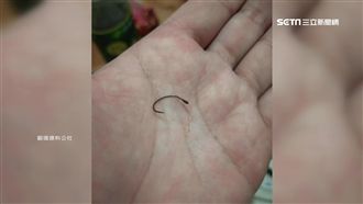 買夜市胡椒蝦　蝦頭藏釣鉤險吃下肚