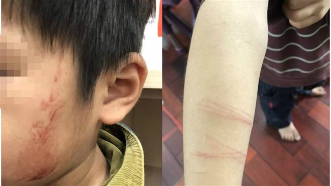 又見虐童！狠母竟指使十歲女兒打弟弟