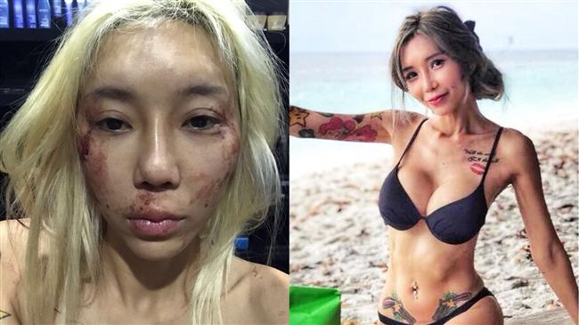 女模遭痛毆爆血　護航「其實他不壞」