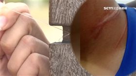 風箏線變凶器!割喉害摔車 騎士脖3條血痕