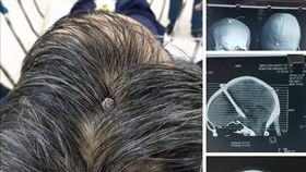 頭痛,釘子,大腦（圖／reddit）