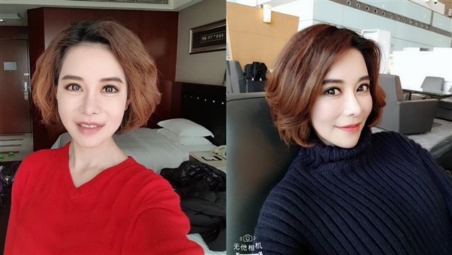 女星自爆整形60次！拔牙下巴還脫臼