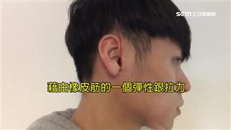 橡皮筋綁耳朵瘦臉　醫：不如醫美