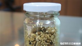 ▲92歲林姓阿公血尿就醫，X光顯示膀胱有「好幾堆」石頭，術後取出上百顆結石連自己都嚇壞了。（圖／彰化醫院提供）