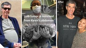  美國,心臟病,肉瘤,脂肪,啤酒肚（圖／翻攝自臉書Lenox Hill Hospital）https://www.facebook.com/lenoxhillhospital/photos/a.10150260789758490.339316.71321473489/10156063377378490/?type=3&theater