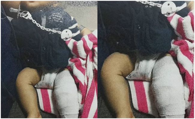 疼痛指數爆表！狠父徒手扭斷男嬰四肢