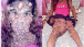 媽媽產後病變「泡泡人」（翻攝自太陽報）