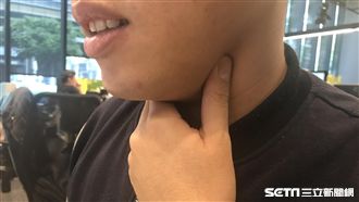 喉嚨痛竟確診4癌症！醫曝3習慣是頭號殺手