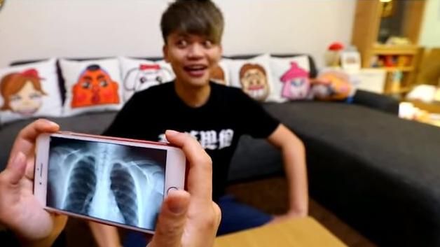 阿嘎揭密i8！手機竟能拍出人體X光