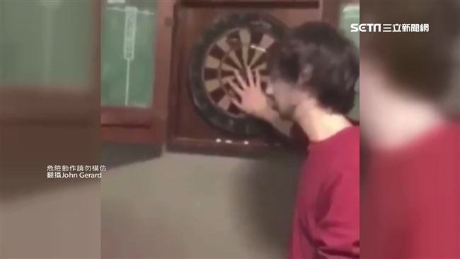 男酒後試膽飛鏢　朋友失手射在額頭上