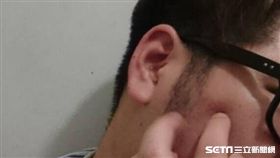 登革熱,抓癢,皮膚過敏,過敏,冬季癢,敏感肌（示意圖／記者楊晴雯攝）