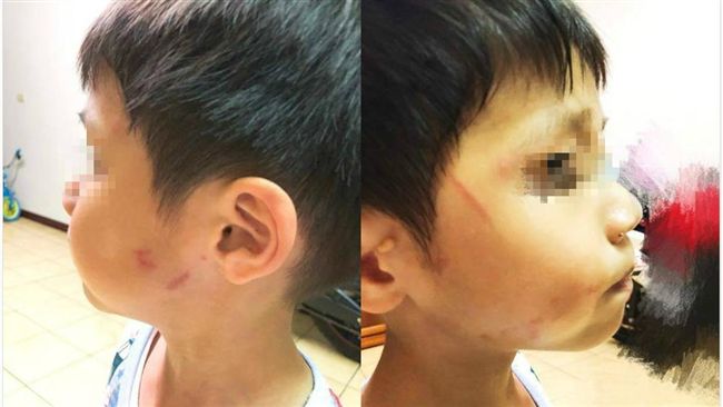 男童慘遭抓臉打耳光　母氣憤報警逮人