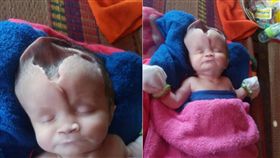 奇蹟！無腦女嬰活下來　家人賣房求醫盼續命(圖／翻攝自The Sun)
