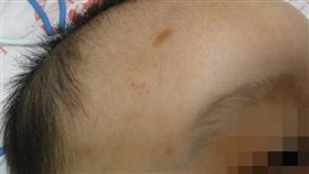 苗栗,家暴,虐童,男嬰,虐待,顱內出血,嗆奶,重傷害罪（圖／翻攝畫面）