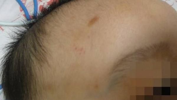4月男嬰嗆奶死亡　驗屍竟揭驚人事實