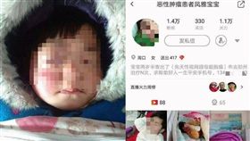 喪心病狂！河南父母竟私扣捐款不送醫　孩子不治身亡（圖／翻攝自人民網微博）