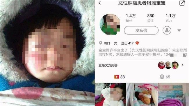 惡劣父母私扣善款消失　女兒重病身亡