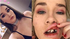 凌晨回家遇襲…女大生「牙齒斷3顆」苦勸：深夜別獨自回家　圖／翻攝自臉書