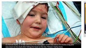 家長注意！4歲童爽跳床　結果頭撞吊扇縫13針　圖／翻攝dailymercury